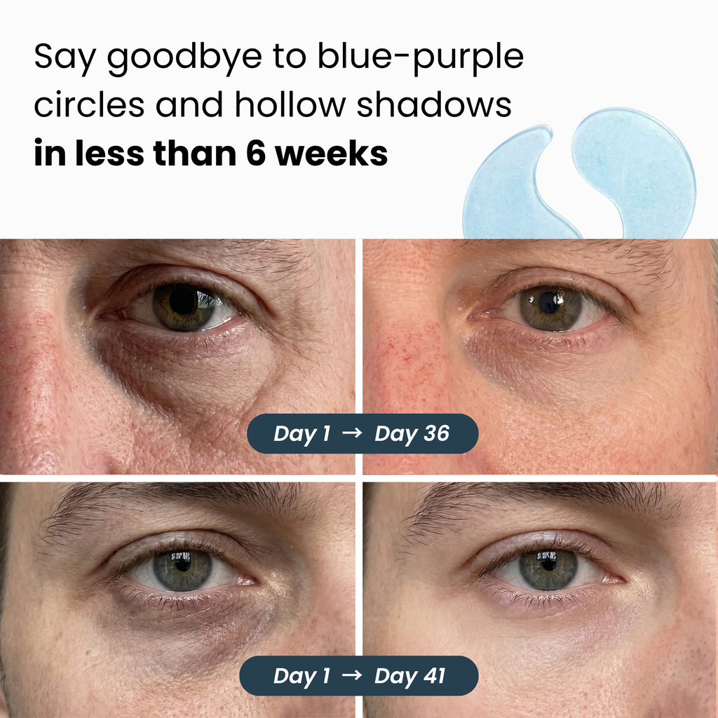 Hydrogel Eye Patches