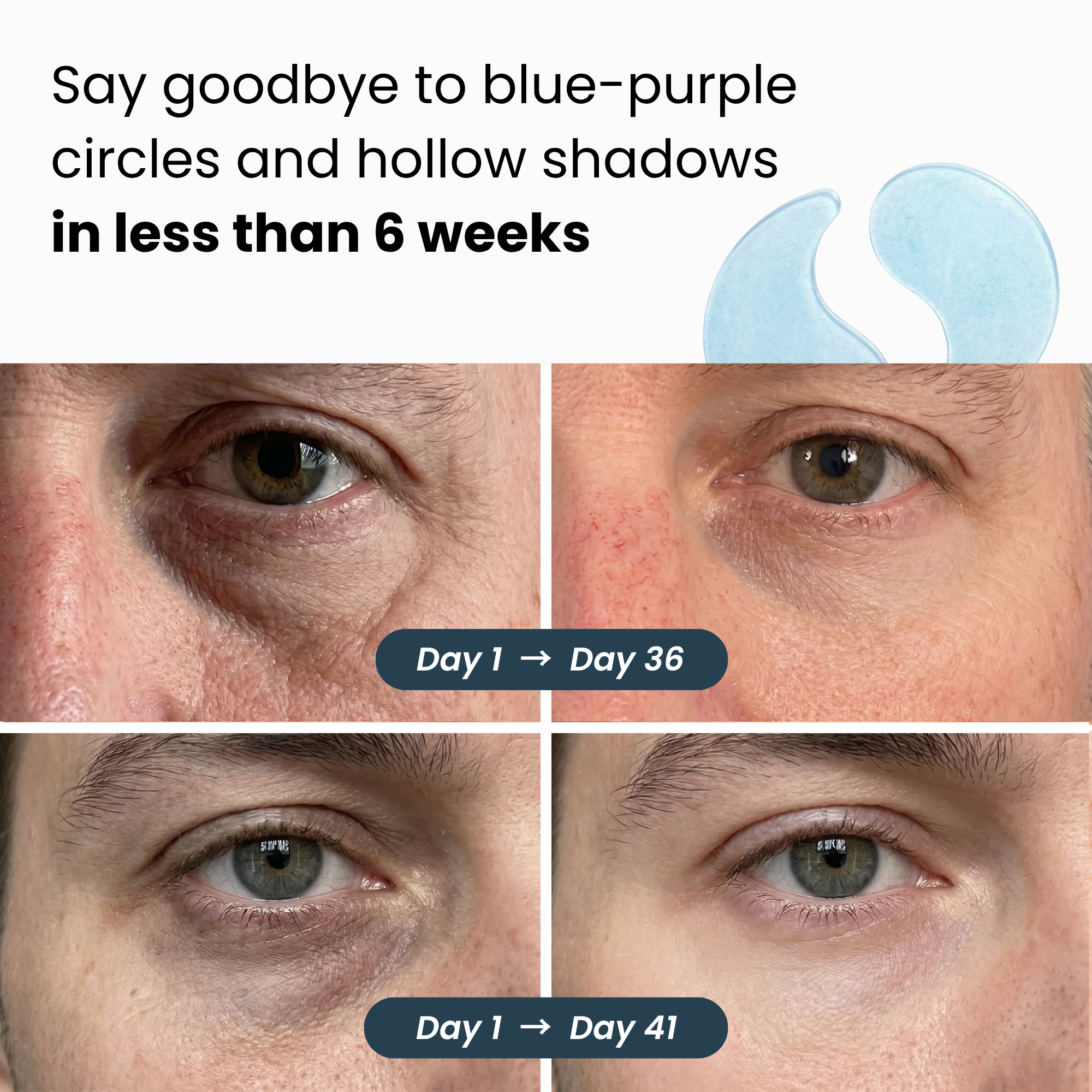 Hydrogel Eye Patches